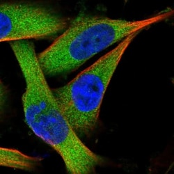 GID4 Antibody, Novus Biologicals:Antibodies:Primary Antibodies